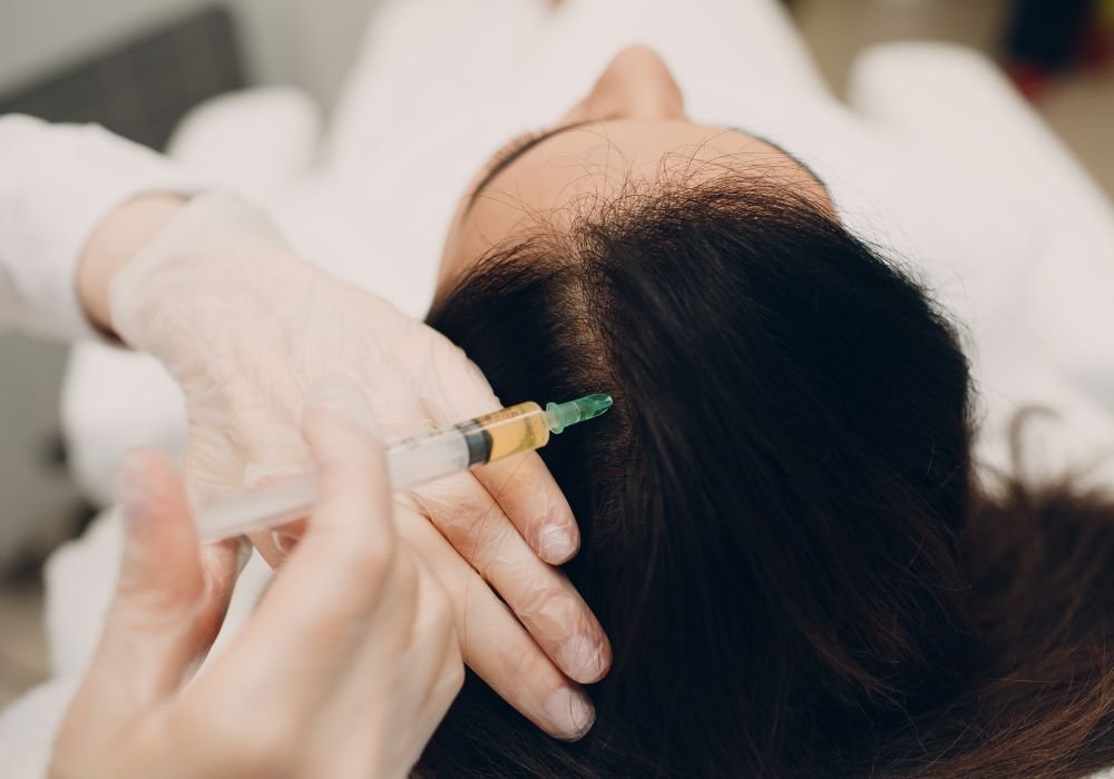 PRP Hair Treatment for Women: Restoring Confidence and Volume